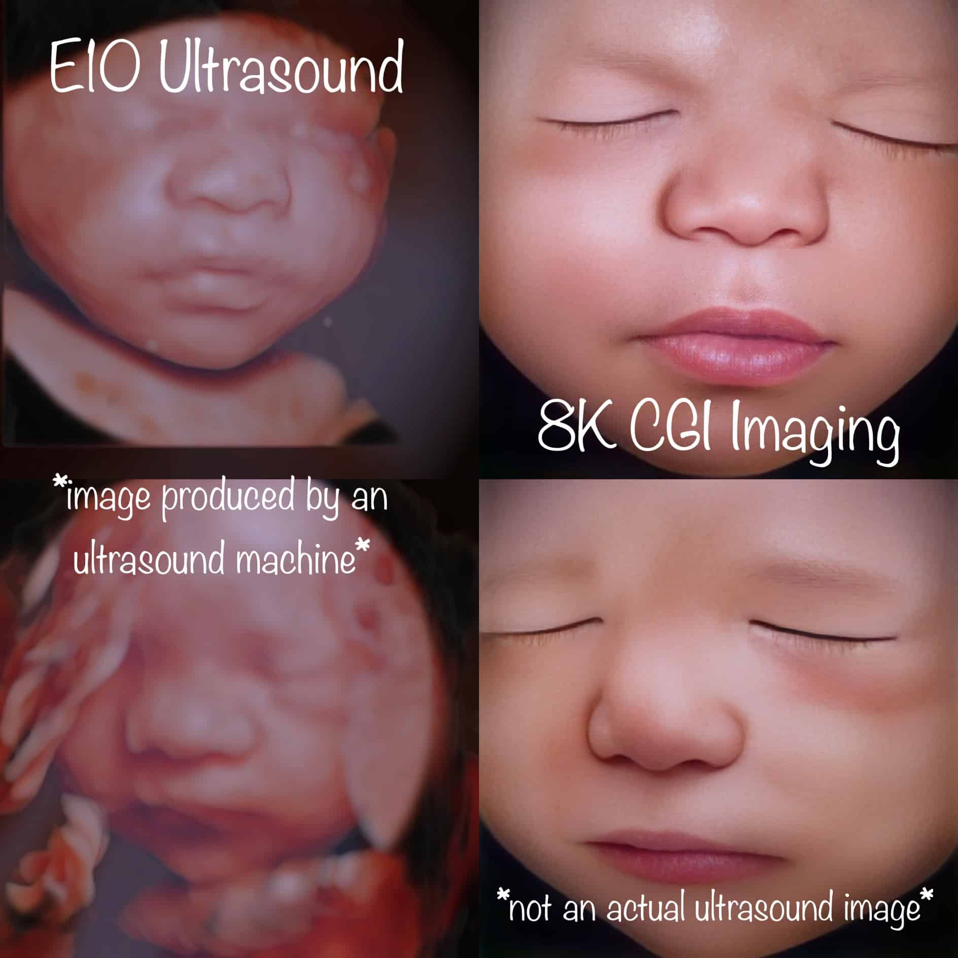 Ultrasound imaging