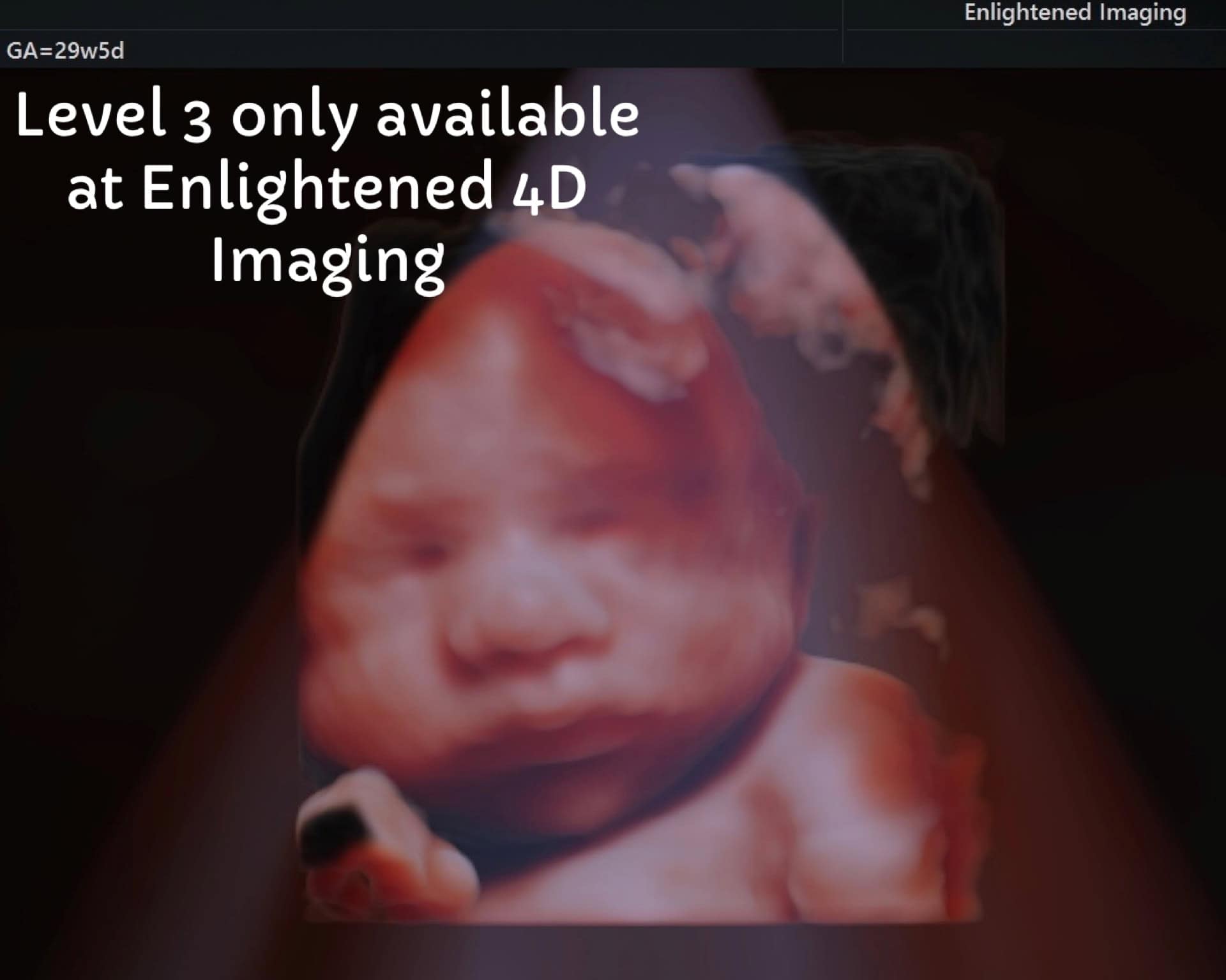 Level 3 imaging platform only available at Enlightened 4D Imaging