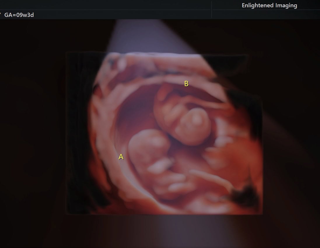 Additional Level 3 imaging example from Enlightened 4D Imaging