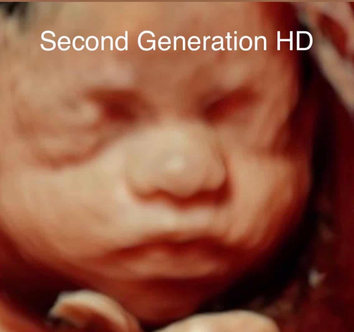Second Generation HD Level 2 imaging platform comparison
