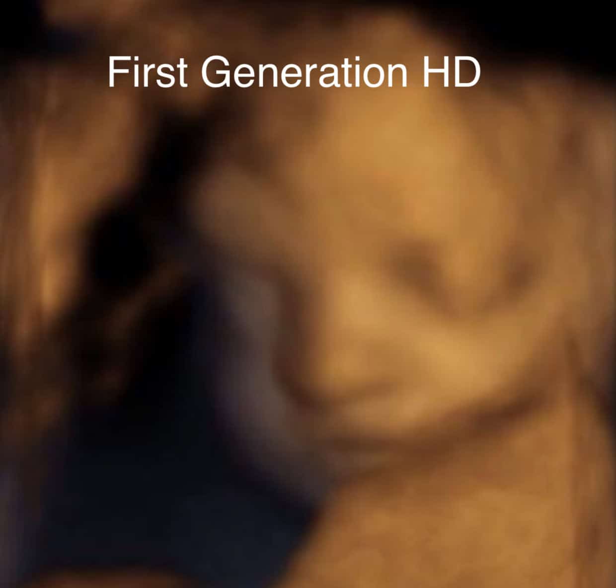 First Generation HD Level 1 imaging platform comparison