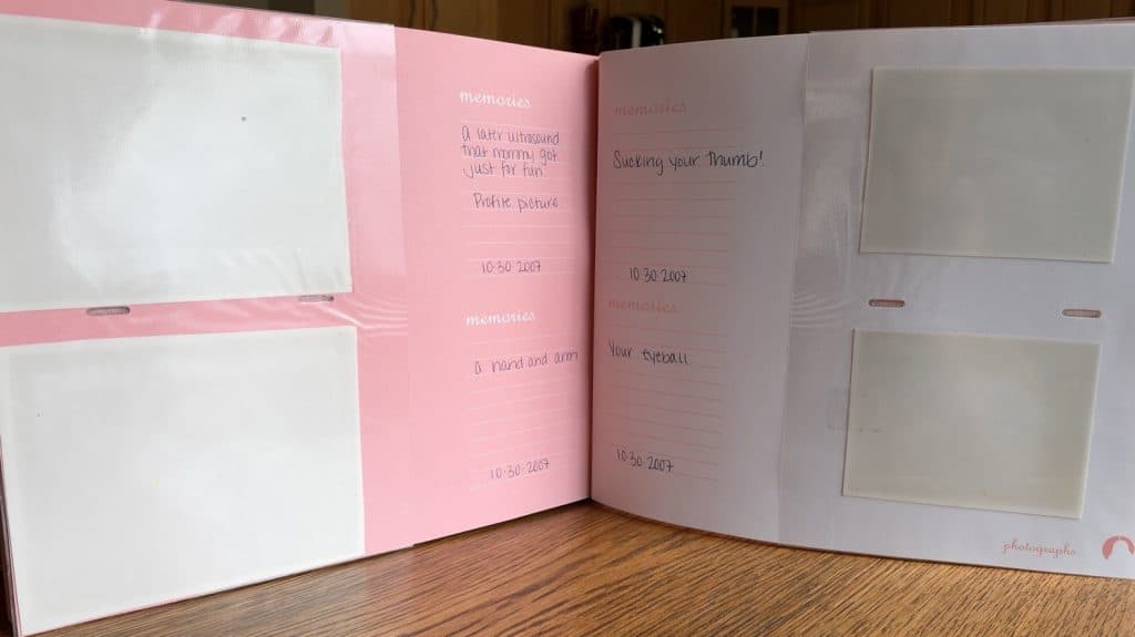 Open baby book with four faded ultrasound prints from 2007 that are now almost blank, next to handwritten notes like “Sucking your thumb!”